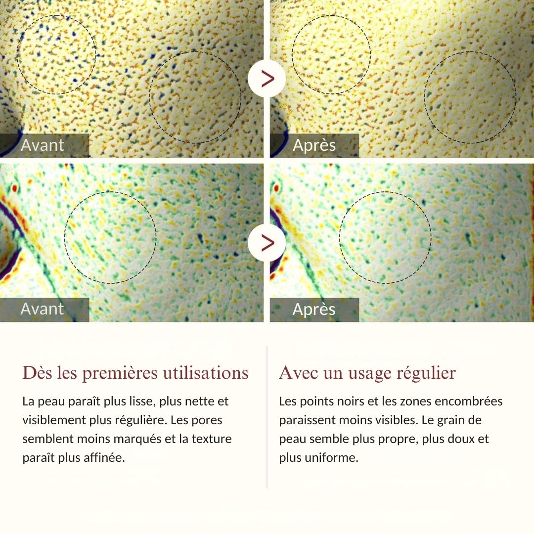 ORIZARA™ Peel Shot — Sérum Exfoliant au Riz