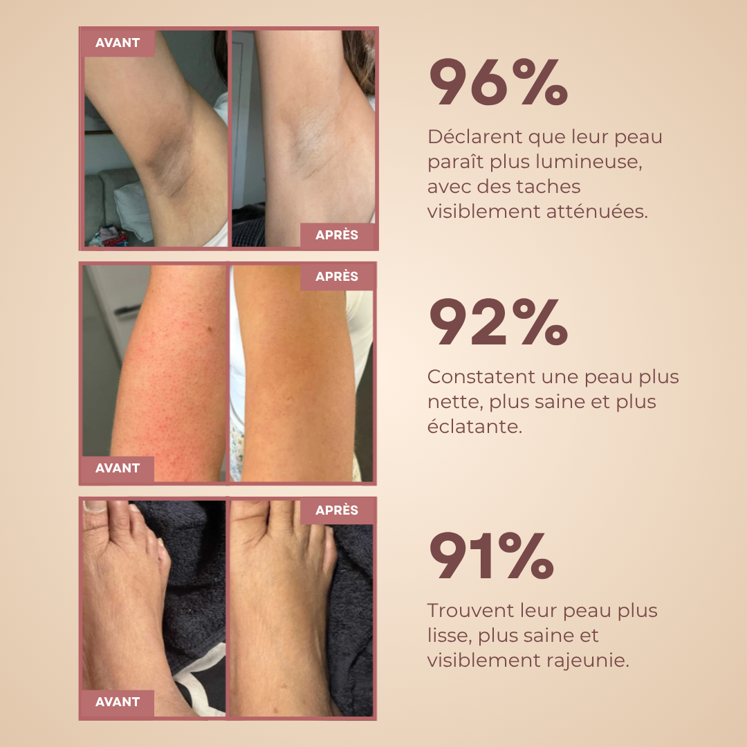 ORIZARA™- Dites adieu à la peau rugueuse et aux taches sombres