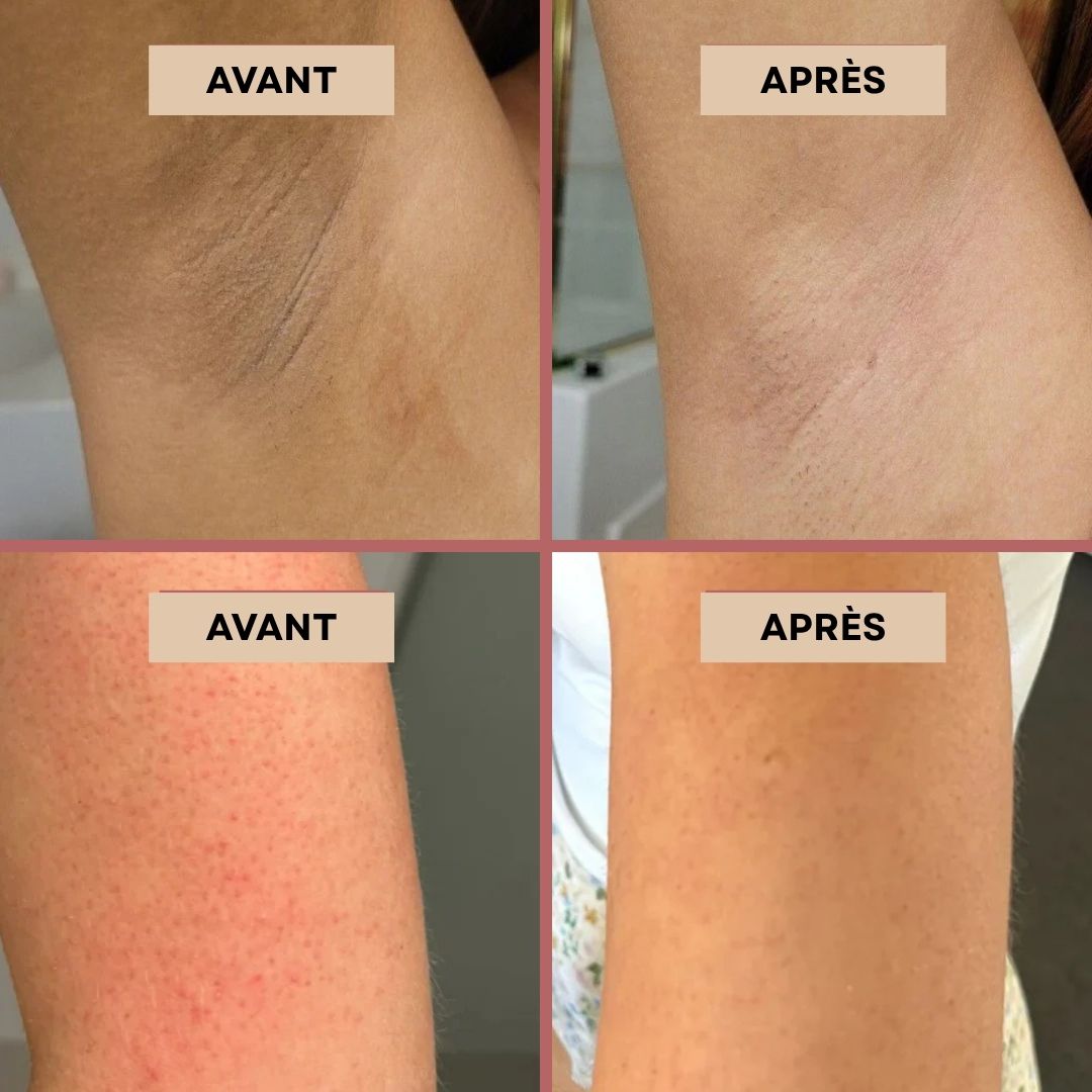 ORIZARA™- Dites adieu à la peau rugueuse et aux taches sombres