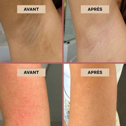 ORIZARA™- Dites adieu à la peau rugueuse et aux taches sombres